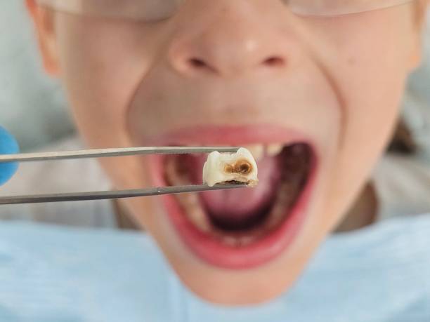Best Emergency Dental Care for Trauma or Injury in Three Oaks, FL